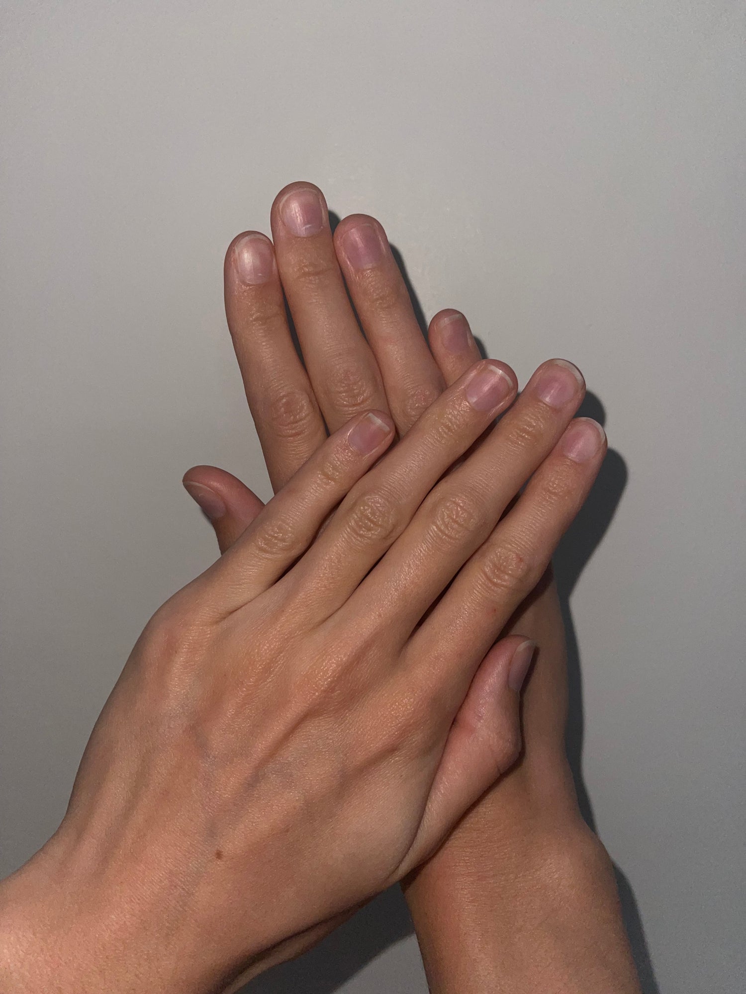 image comparison before
